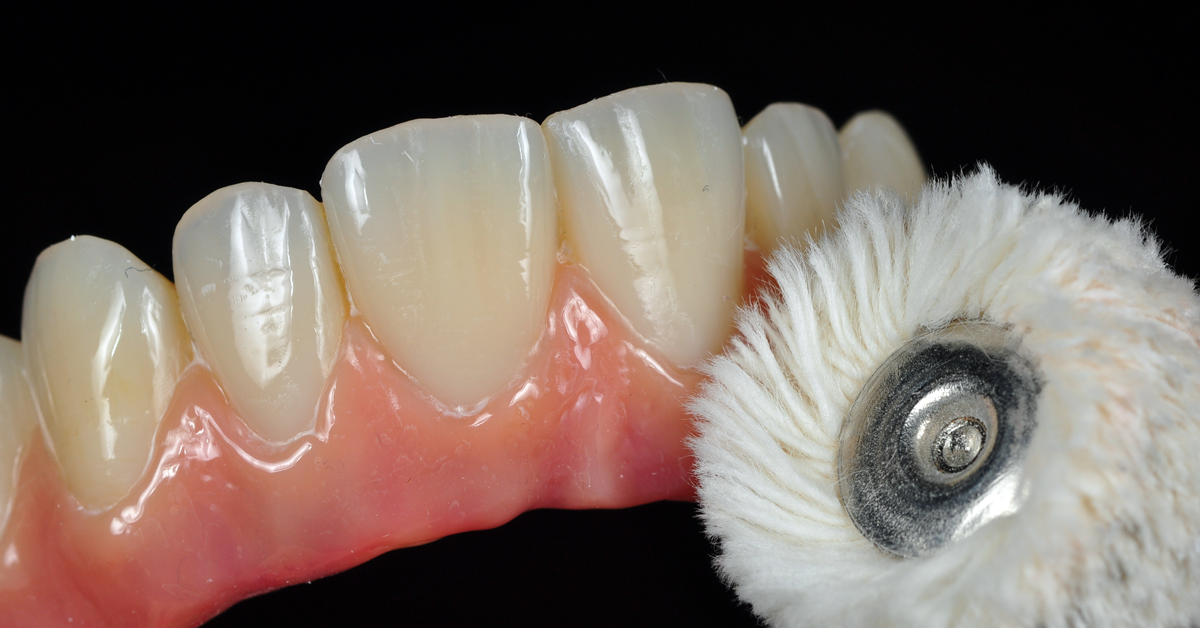 Por qué debe trabajar con composites de laboratorio ITD Instituto